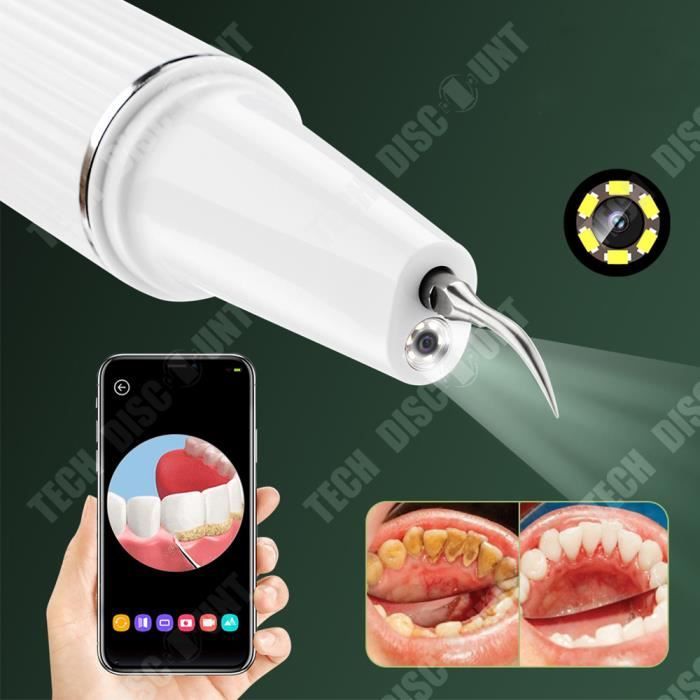 Nettoyeur de dents à ultrasons 3 vitesses réglables Soins dentaires Nettoyage visuel des dents Détartreur électrique – Image 2