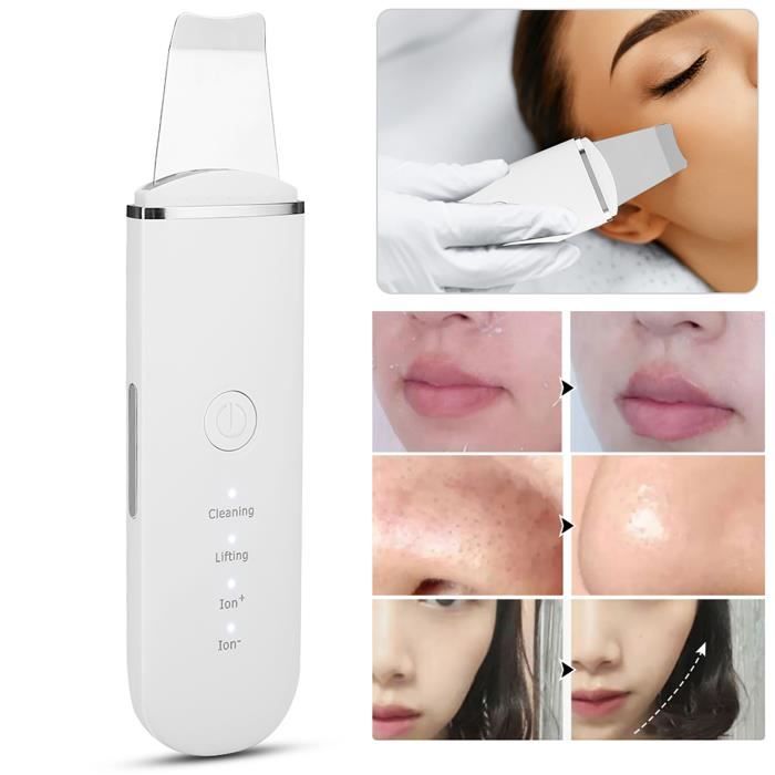 Épurateur de peau de visage ultrasons portable ZERODIS - Blanc - 500 mAh - Léger et portable – Image 2